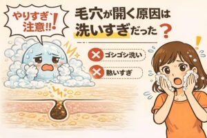 毛穴が開く原因として「洗いすぎ」に注意を促す解説イラスト。泡に包まれてダメージを受けた肌と、ゴシゴシ洗い・熱いお湯といった過剰な洗顔行為がNGとして示されている。毛穴断面図では刺激によって毛穴が開いてしまう様子が描かれ、洗いすぎが開き毛穴の原因になる可能性を視覚的に伝えている。