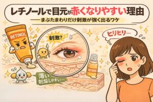 レチノール使用で目元が赤くなりやすい理由を解説するイラスト。中央に目元の皮膚断面を拡大した図が描かれ、皮膚が薄く乾燥しやすいため刺激を受けやすいことが示されている。左にはレチノールチューブのキャラクター、右には目元を押さえて「ヒリヒリ…」と困った表情の女性が描かれ、まぶた周りだけ刺激が強く出る仕組みを視覚的に説明している。