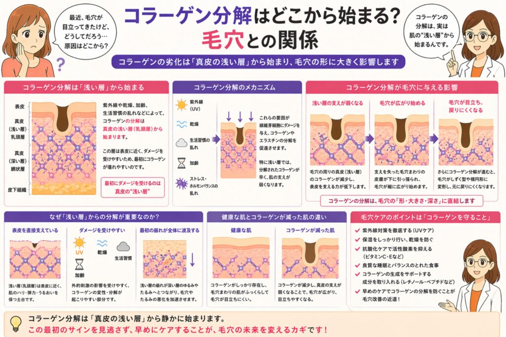 「コラーゲン分解はどこから始まる？毛穴との関係」と書かれた日本語インフォグラフィック。左に悩む女性、右に白衣の女性が配置され、中央にはコラーゲン分解が真皮の浅い層から始まり、毛穴の形や大きさに影響を与える過程が図解されている。下部には紫外線や乾燥などの原因、分解のメカニズム、毛穴への影響、ケアのポイントが整理されている。