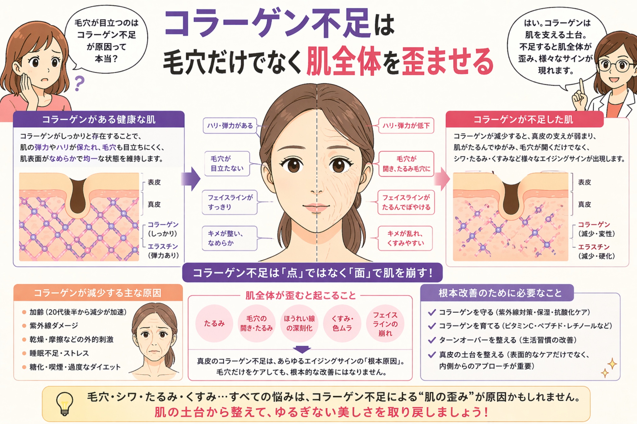 「コラーゲン不足は毛穴だけでなく肌全体を歪ませる」と書かれた日本語インフォグラフィック。中央に左右で比較された女性の顔があり、コラーゲンが十分な肌と不足した肌の違い（毛穴の目立ち、たるみ、くすみなど）が示されている。左右には真皮構造の比較図も配置され、下部にはコラーゲン減少の原因や改善のポイントがまとめられている。