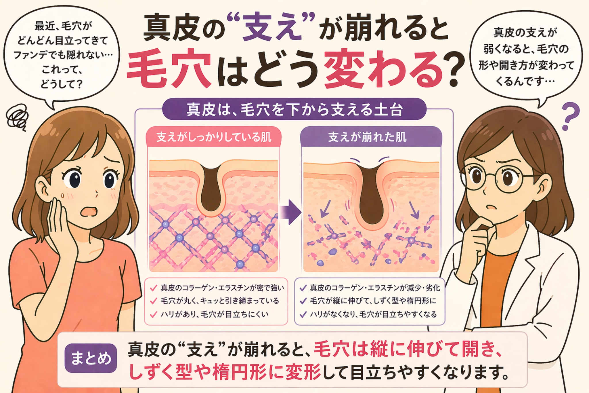 「真皮の“支え”が崩れると毛穴はどう変わる？」というタイトルの日本語インフォグラフィック。左に悩む女性、右に白衣の女性が配置され、中央には真皮の構造がしっかりしている肌と崩れた肌の比較図があり、毛穴が引き締まった状態から縦に伸びてしずく型や楕円形に変形する様子が示されている。下部にはまとめとして、真皮の支えが弱くなると毛穴が目立ちやすくなるという説明が強調されている。