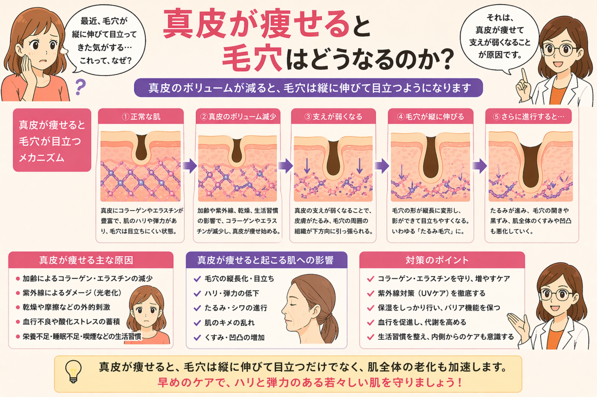 「真皮が痩せると毛穴はどうなるのか？」というタイトルの日本語インフォグラフィック。左に悩む女性、右に白衣の女性が配置され、中央には正常な肌から真皮のボリューム減少、支えの低下を経て毛穴が縦に伸びて目立つまでの過程が段階的に図解されている。下部には真皮が痩せる原因や肌への影響、対策ポイントがまとめられている。