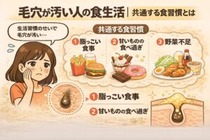 毛穴が汚い人の食生活と共通する習慣を解説した図解イラスト。脂っこい食事、甘いものの食べ過ぎ、野菜不足の3つの食習慣が並び、毛穴に角栓が詰まる様子の断面図とともに説明されている。悩む女性キャラクターが配置されている。