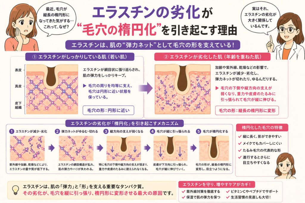 「エラスチンの劣化が毛穴の楕円化を引き起こす理由」と書かれた日本語インフォグラフィック。左に悩む女性、右に白衣の女性が配置され、中央にはエラスチンが正常な肌と劣化した肌の比較図があり、毛穴が円形から縦長の楕円形へ変形する過程が段階的に示されている。下部にはエラスチン劣化のメカニズムやケア方法がまとめられている。