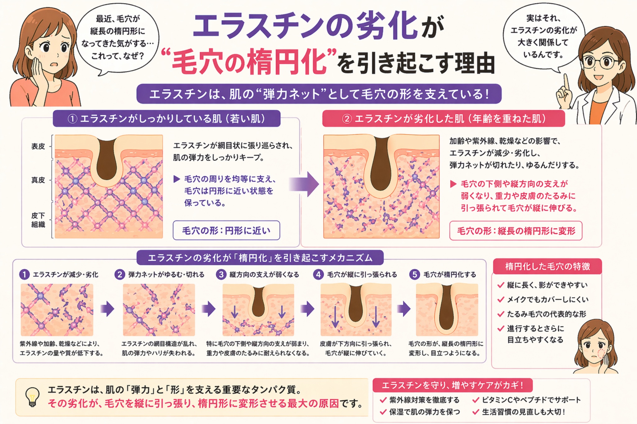 「エラスチンの劣化が毛穴の楕円化を引き起こす理由」と書かれた日本語インフォグラフィック。左に悩む女性、右に白衣の女性が配置され、中央にはエラスチンが正常な肌と劣化した肌の比較図があり、毛穴が円形から縦長の楕円形へ変形する過程が段階的に示されている。下部にはエラスチン劣化のメカニズムやケア方法がまとめられている。