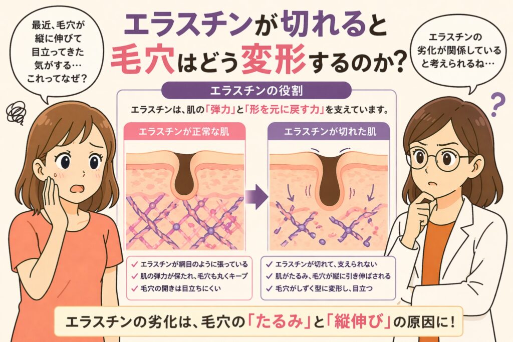 「エラスチンが切れると毛穴はどう変形するのか？」というタイトルの日本語インフォグラフィック。左に悩む女性、右に白衣の女性が配置され、中央にはエラスチンが正常な肌と切れた肌の比較図があり、毛穴が丸い状態から縦に伸びて変形する様子が示されている。下部には「エラスチンの劣化は毛穴のたるみと縦伸びの原因に！」というメッセージが強調されている。