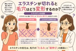 「エラスチンが切れると毛穴はどう変形するのか？」というタイトルの日本語インフォグラフィック。左に悩む女性、右に白衣の女性が配置され、中央にはエラスチンが正常な肌と切れた肌の比較図があり、毛穴が丸い状態から縦に伸びて変形する様子が示されている。下部には「エラスチンの劣化は毛穴のたるみと縦伸びの原因に！」というメッセージが強調されている。