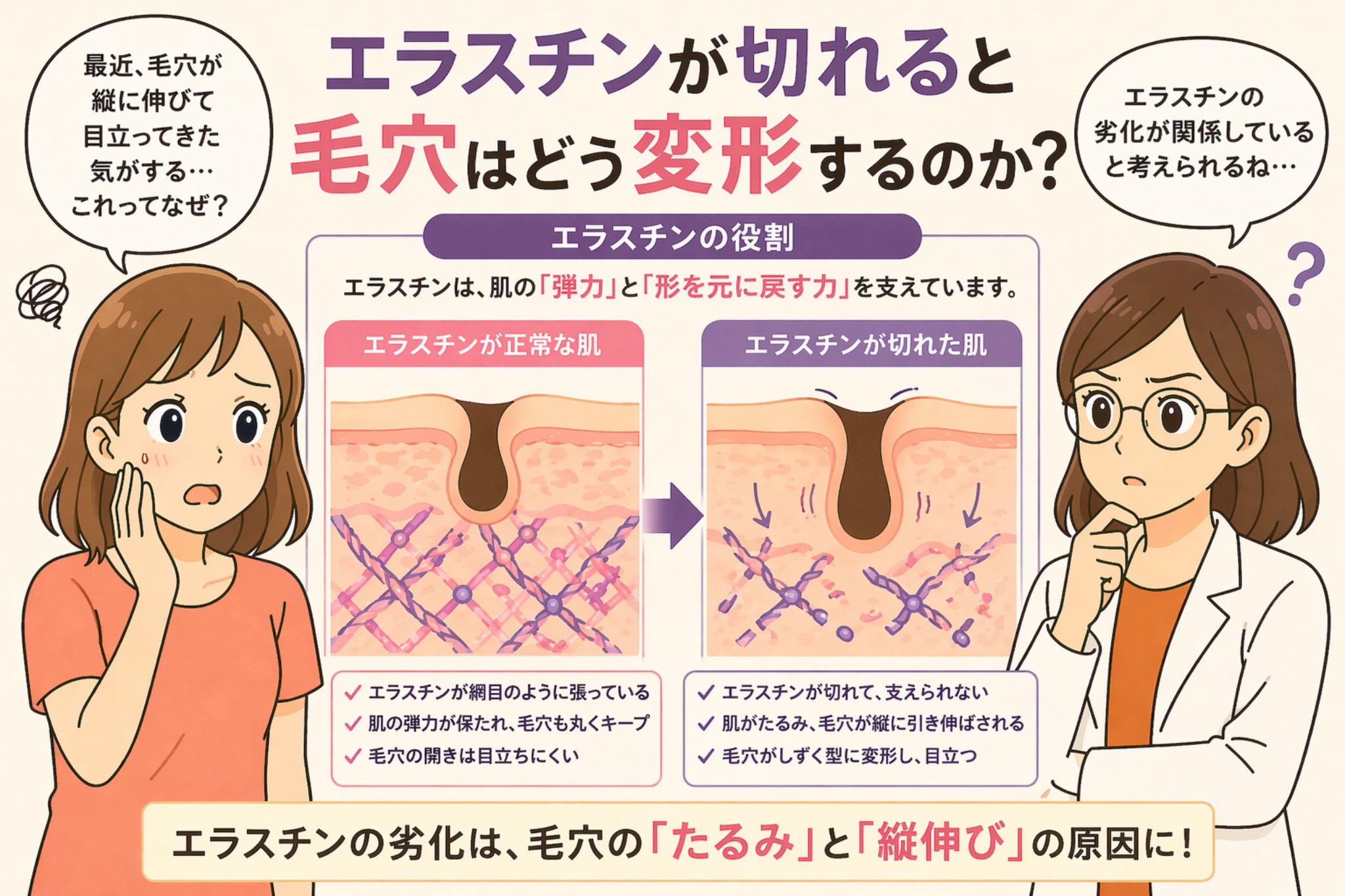 「エラスチンが切れると毛穴はどう変形するのか？」というタイトルの日本語インフォグラフィック。左に悩む女性、右に白衣の女性が配置され、中央にはエラスチンが正常な肌と切れた肌の比較図があり、毛穴が丸い状態から縦に伸びて変形する様子が示されている。下部には「エラスチンの劣化は毛穴のたるみと縦伸びの原因に！」というメッセージが強調されている。