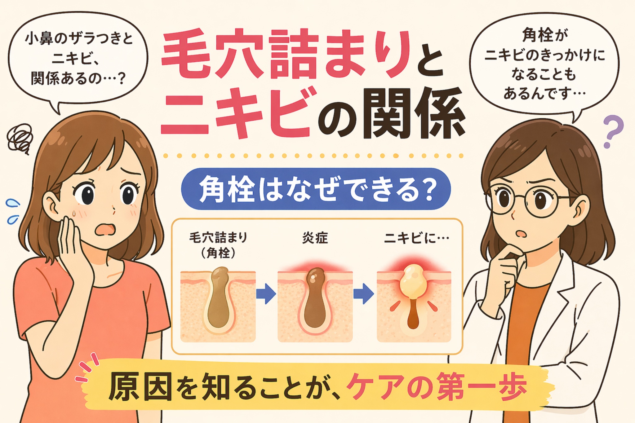 「毛穴詰まりとニキビの関係」と書かれた日本語インフォグラフィック。左に困った表情の女性、右に考える白衣の女性が配置され、中央には「角栓はなぜできる？」という見出しと、毛穴詰まり（角栓）→炎症→ニキビへと進行する図解が描かれている。下部には「原因を知ることが、ケアの第一歩」というメッセージが黄色の帯で強調されている。