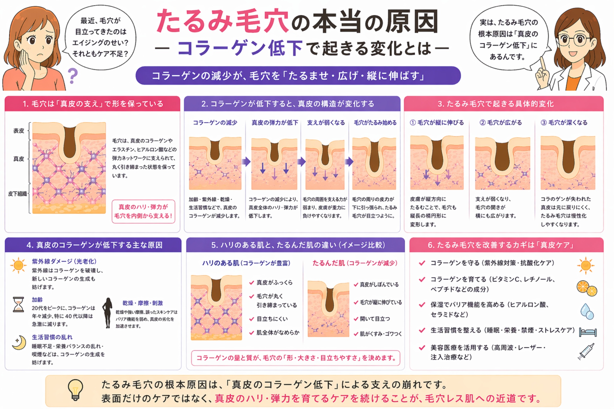 「たるみ毛穴の本当の原因 ―コラーゲン低下で起きる変化とは―」と書かれた日本語インフォグラフィック。左に悩む女性、右に白衣の女性が配置され、中央にはコラーゲンの減少によって真皮の構造が弱まり、毛穴が縦に伸びて目立つまでの過程が段階的に図解されている。下部には原因（紫外線・加齢・生活習慣など）や肌への影響、真皮ケアの重要性が整理されている。