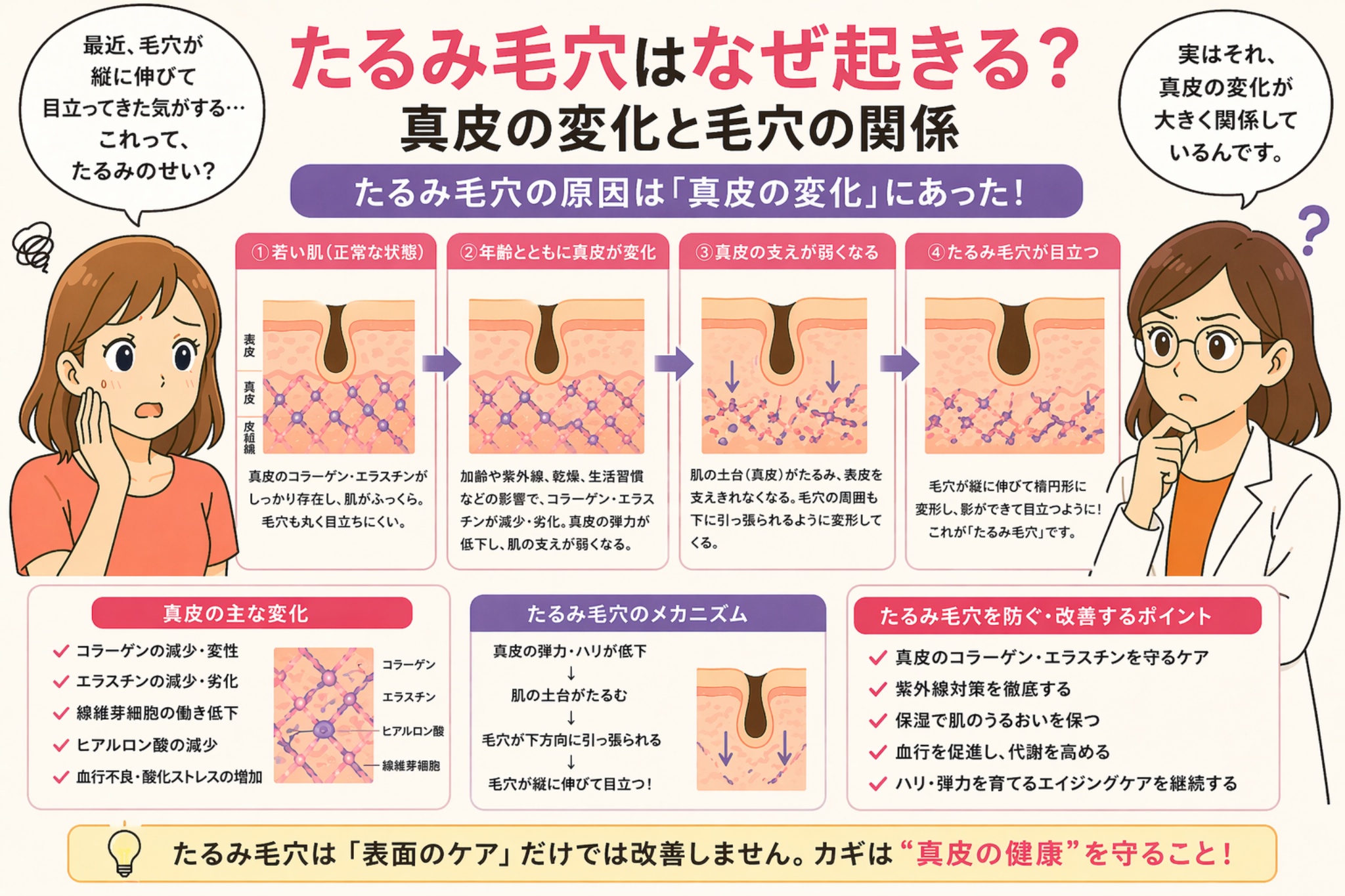 「たるみ毛穴はなぜ起きる？真皮の変化と毛穴の関係」と書かれた日本語インフォグラフィック。左に悩む女性、右に白衣の女性が配置され、中央には若い肌から加齢に伴う真皮の変化を経て、毛穴が縦に伸びて目立つまでの過程が段階的に図解されている。下部には真皮の変化（コラーゲン・エラスチンの減少など）と対策ポイントが整理され、「表面ケアだけでは改善しない」というメッセージが強調されている。