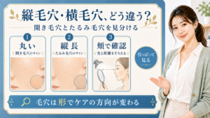丸い毛穴・縦長毛穴・頬で確認する見分け方を説明する解説ボード