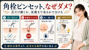 角栓ピンセットがなぜだめかを芯だけ動く条件と皮膚まで上がる赤信号で説明するアイキャッチ