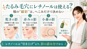 たるみ毛穴にレチノールは使える？頬の縦影を乾き・赤み・小鼻で分ける解説ボード