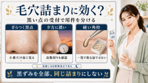 サリチル酸と毛穴詰まりでは黒ずみを全部同じ詰まりにせず黒い点の用件を分けることを示すアイキャッチ