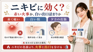 サリチル酸とニキビでは赤い火事と白い出口詰まりを分けて見ることを示すアイキャッチ