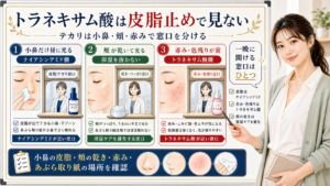 トラネキサム酸は皮脂止めで見ない。小鼻の皮脂、頬の乾き、赤み・色残りで窓口を分ける図解。