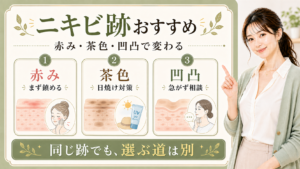 ニキビ跡におすすめは赤み茶色凹凸で選び方が変わる
