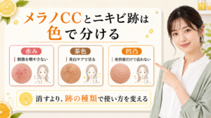 メラノCCをニキビ跡に使う前に赤み、茶色、凹凸で分ける美容解説ボード