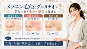 メラニン毛穴とグルタチオンをざらつき・赤み・茶色い影で整理する美容解説ボード