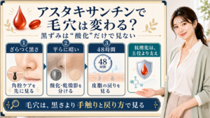 アスタキサンチンと毛穴の黒ずみを角栓・酸化影・皮脂戻りで整理する美容解説ボード