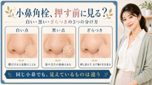小鼻のざらつきを白い点、黒い点、ざらつきに分ける3カード図