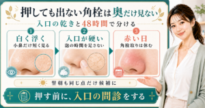 押しても出ない角栓は奥だけ見ない