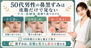 50代男性の鼻黒ずみは皮脂だけで見ない