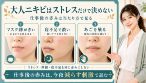 大人ニキビはストレスだけで決めない