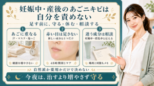 妊娠中・産後のあごニキビは自分を責めない