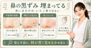 角栓が原因のいちご鼻？黒ずみ以外の詰まりと戻り方