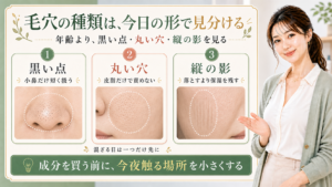 毛穴の種類を黒い点・丸い穴・縦の影で見分ける解説ボード