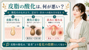 皮脂の酸化が毛穴詰まりや赤みやニキビに進む流れを説明する美容解説ボード