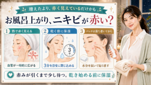 お風呂上がりのニキビ赤みを熱で赤く見える・乾く前に保湿・パッチは落ち着いてからで説明する美容解説ボード