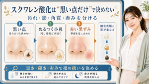 スクワレン酸化は黒い点だけで決めない。黒い点、ぬるつく小鼻、赤い黒ずみを分けて確認する図解。