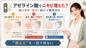 アゼライン酸でニキビが増えた時に白ニキビ赤み痛みで信号分けするアイキャッチ