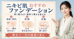 ニキビ肌のファンデーションを炎症・乾燥・皮脂の場所別に選ぶ美容解説ボード