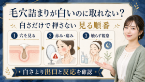 白い毛穴詰まりが取れないときは？無理に押す前の見分け方の検索クエリ起点ビューティーボード