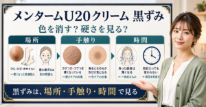 メンソレータムアクネスU20クリームはニキビ跡に使える？の判断ポイントを示すアイキャッチ