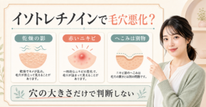 イソトレチノインで毛穴が悪化したように見えるときの確認点の判断ポイントを示すアイキャッチ