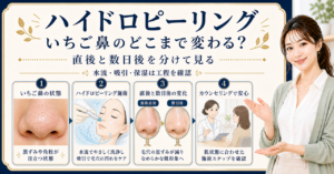 施術と自宅ケアの境界から考えるハイドロピーリングといちご鼻