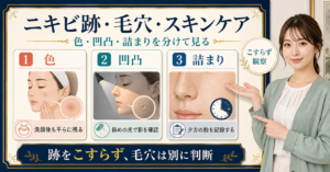 ニキビ跡の色・毛穴の凹凸・詰まりを分けて観察する図解