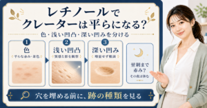 レチノールとニキビ跡のクレーターをセルフケアと相談の境界で考えるボード