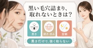 黒い毛穴詰まりが取れないときの色と硬さと肌の反応を示すビューティーボード