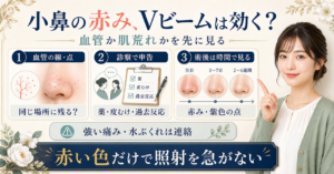 小鼻の赤みをVビームの適応と皮膚科相談の境界で整理する図解