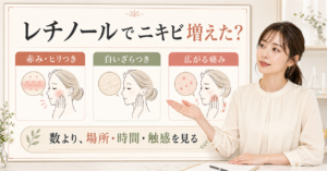 レチノールでニキビが増えたときの観察と見直しを示す美容ボード
