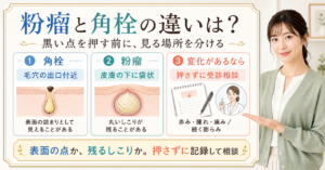 粉瘤と角栓の違いを確認するアイキャッチ