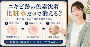 ニキビ跡の色素沈着を赤み、紫外線、摩擦、保湿で分けて化粧水を選ぶ図解
