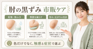 肘の黒ずみを乾燥、摩擦、厚み、かゆみで分けて市販ケアを選ぶ図解
