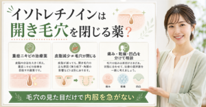 イソトレチノイン 開き毛穴の判断ポイントを整理した美容ボード